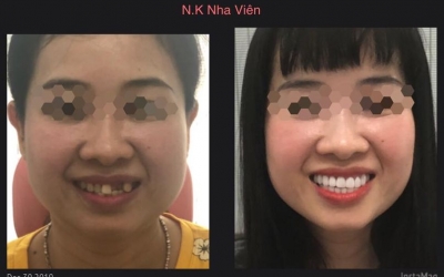 CASE thẩm mỹ ở Quận Tân Phú